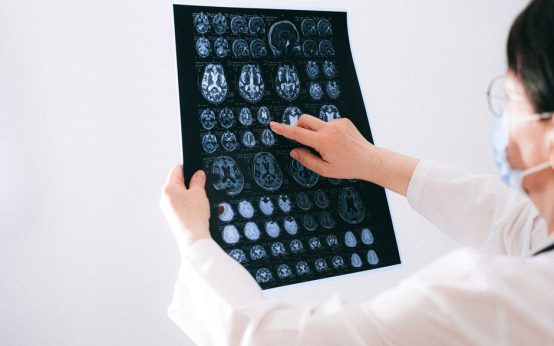 Imagen conceptual de investigación médica sobre tumores cerebrales en un hospital español
